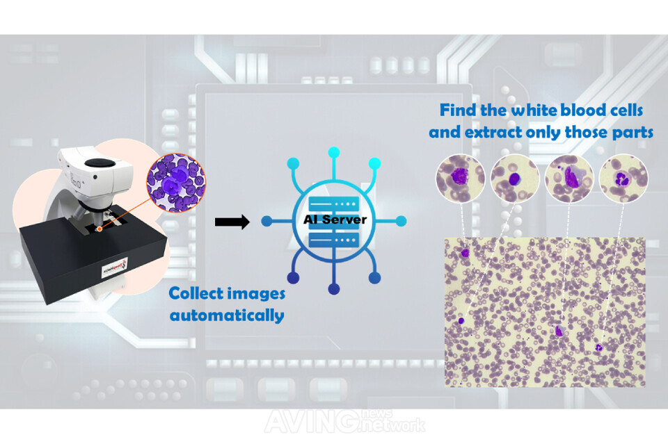 딥헬릭스, CES 2024서 백혈구 이미지 자동 분류 솔루션 'Deepcellpic' 알린다... - 뉴스 썸네일 이미지