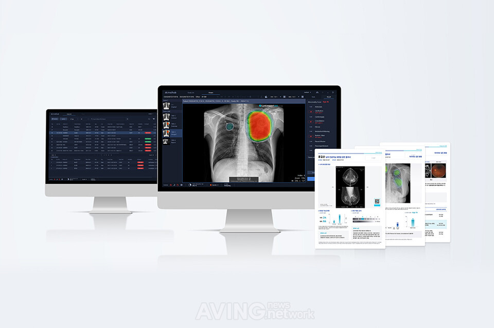 마이허브, KIMES BUSAN 2025서 의료 AI 통합 플랫폼 ‘마이링크(maiLink)’ 알린다... “국내 넘어 글로벌 진출 본격화” 관련 사진
