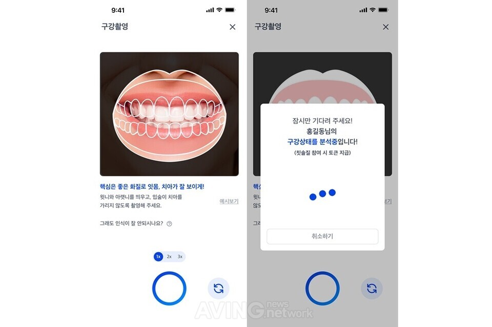 토마스톤, BIBAN 2025 참가... AI 기반 구강 건강관리 솔루션 '덴티캐시(... - 뉴스 썸네일 이미지