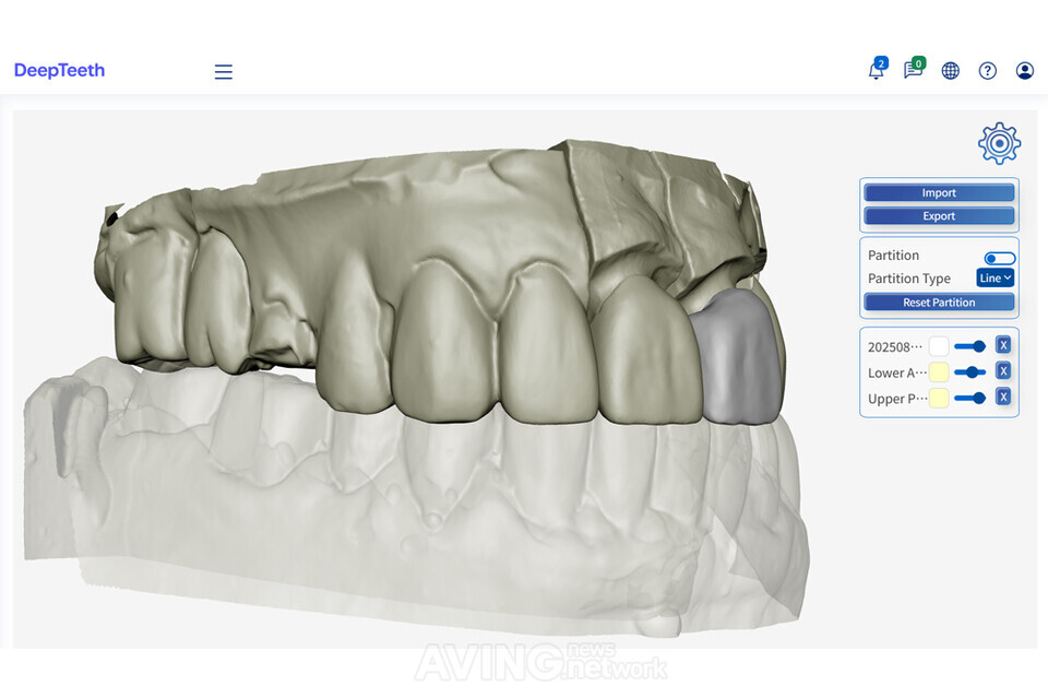 빛날덴탈스튜디오, 컴업(COMEUP) 2025서 치아 디자인 자동화 엔진 'DeepTe... - 뉴스 썸네일 이미지