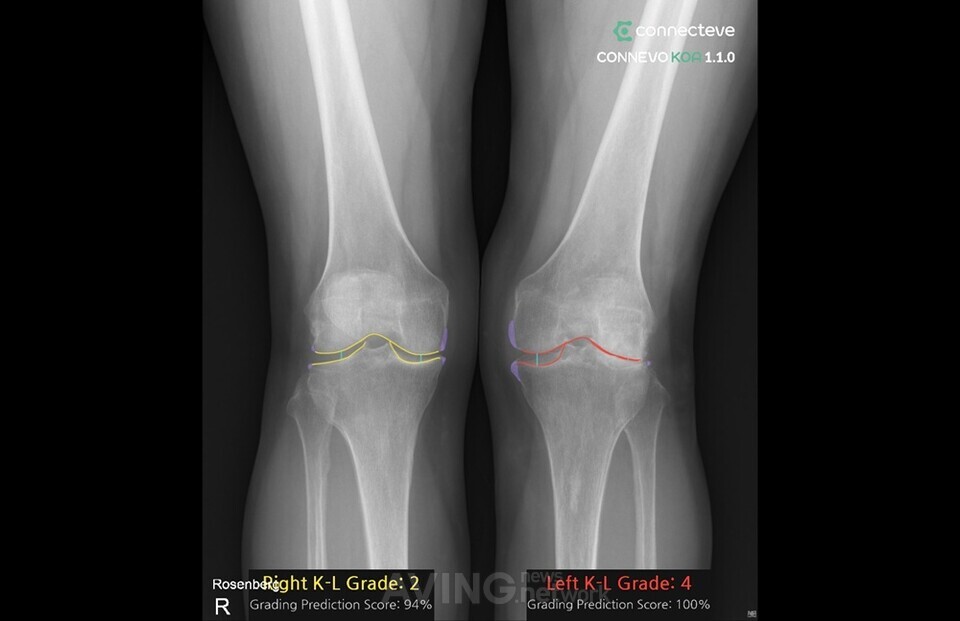 코넥티브, KIMES 2026서 의료 AI 솔루션 'CONNEVO' 라인업 공개... "근골격... - 뉴스 썸네일 이미지