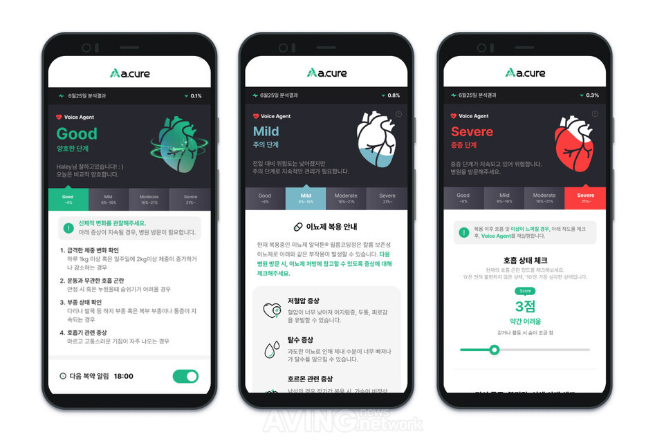 에이닷큐어, KIMES 2026서 '음성 분석'으로 심부전 재입원 막는 AI 의료기... - 뉴스 썸네일 이미지