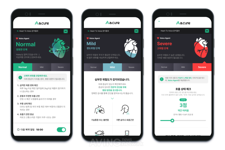 에이닷큐어, WIS 2026서 심부전 모니터링 AI SaMD 'Heart to Voice' 공개..... - 뉴스 썸네일 이미지