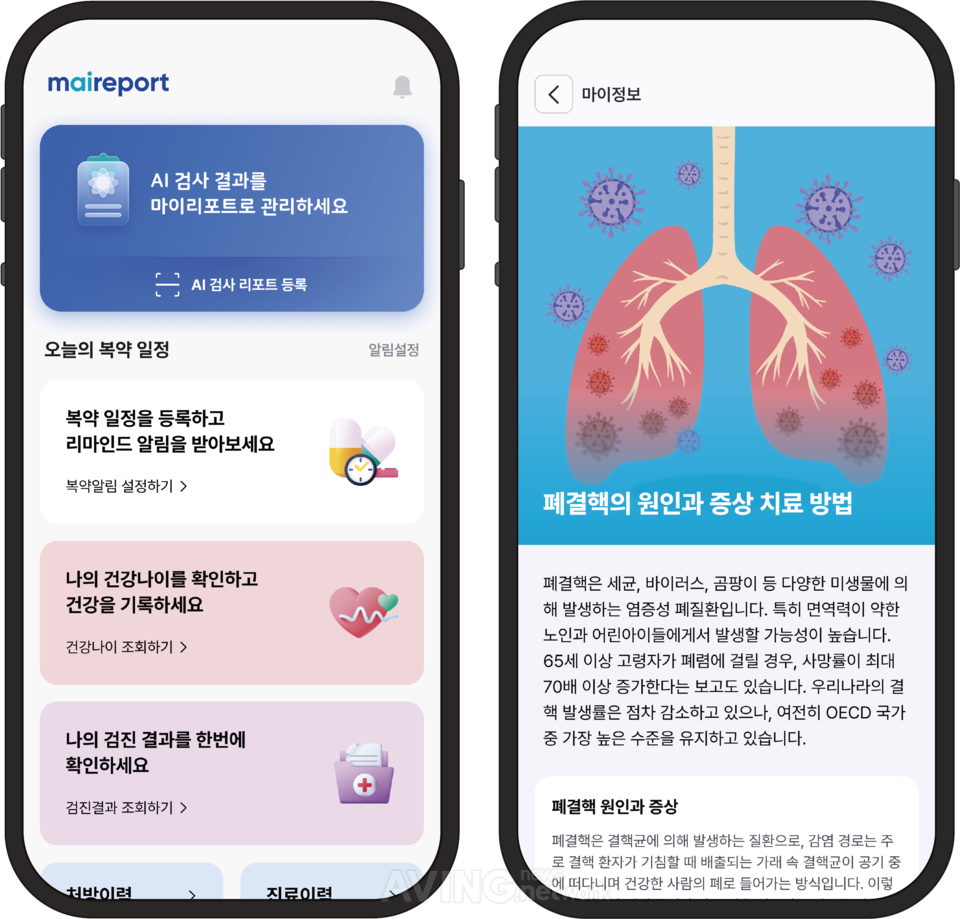 마이허브, WIS 2026서 의료 AI 통합 플랫폼 '마이링크' 공개... "글로벌 의... - 뉴스 썸네일 이미지