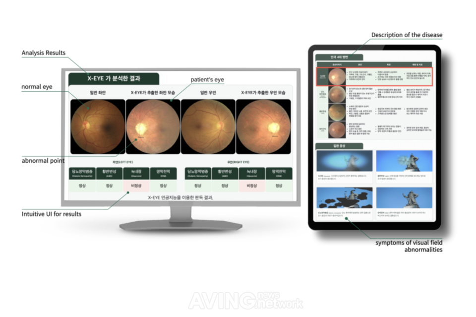 파이헬스케어, AI EXPO KOREA 2026서 안저 AI 'DOCTOREYE Project' 공개...... - 뉴스 썸네일 이미지