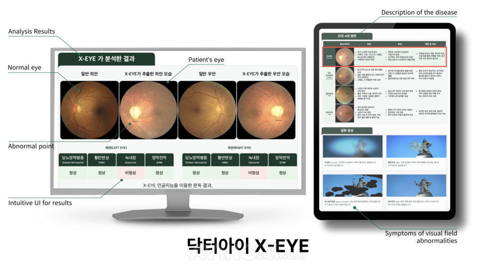 파이헬스케어, AI EXPO KOREA 2026서 디지털AI의료기기 '닥터아이' 공개.... - 뉴스 썸네일 이미지
