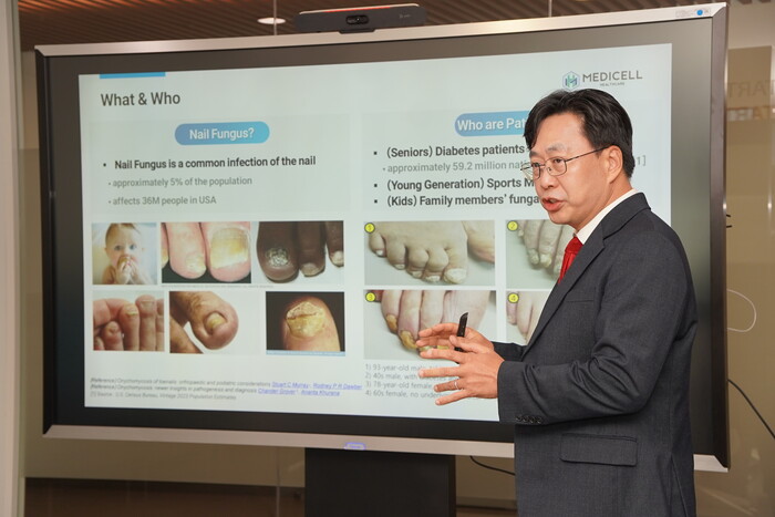 메디셀헬스케어, 손발톱 무좀 잡는 '마이코시스레이저'로 미국·브라질... - 뉴스 썸네일 이미지