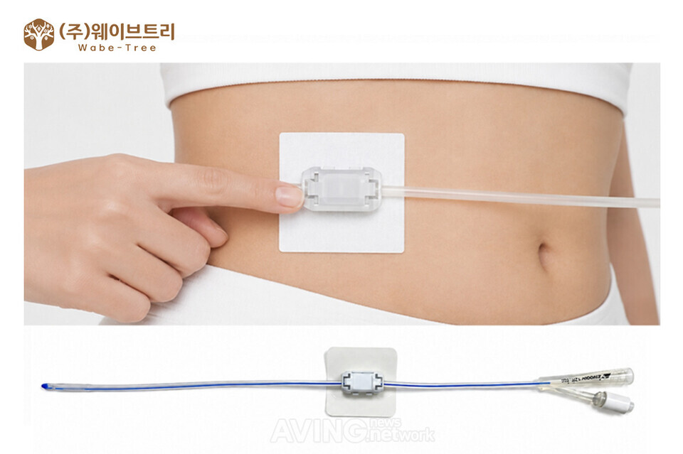 웨이브트리, KIMES BUSAN 2026서 카테터 고정 클립 'WBT-Clip' 선보여... ... - 뉴스 썸네일 이미지